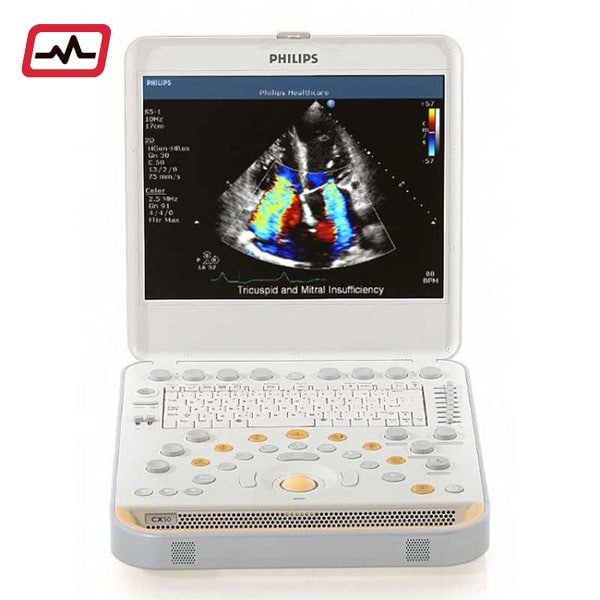 Philips-CX-50-Ultrasound