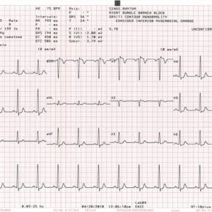 Schiller paper
