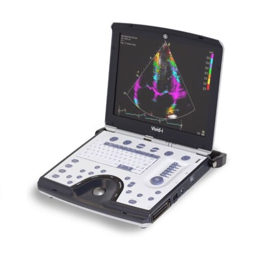 GE Vivid i Portable Ultrasound | Cardiac & Vascular