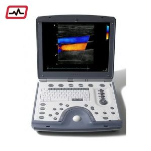 GE-Vivid-i-Portable-Ultrasound